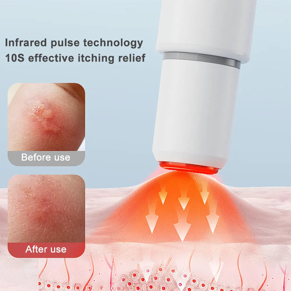 Stylo Thermique Anti-Piqûres de Moustiques – Soulagement Rapide des Démangeaisons pour Adultes et Enfants
